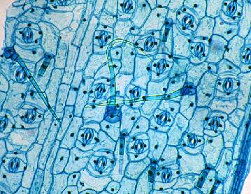 Photo showing the epidermis of plant cells, including trichomes and stomata.