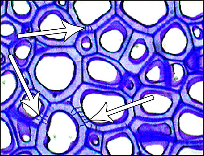 Photo of cells with the plasmadesmata pointed out.