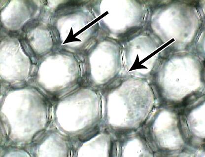 Photo of collenchyma cells with the thickened primary cell walls.