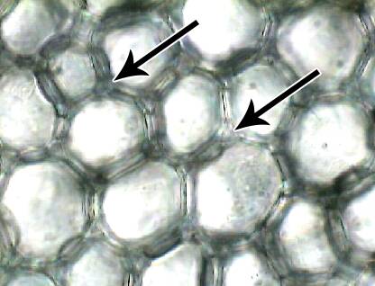 collenchyma cells stem