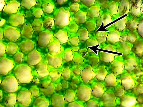 Photo of celery cells with the x-shaped marks between cells pointed out.