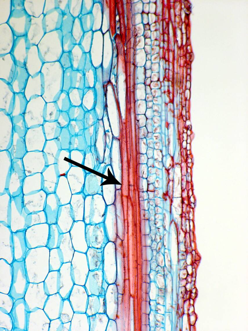Photo of plant cell material pointing out fibers.