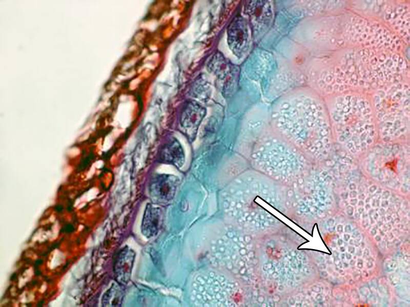 Photo pointing out amyloplasts in grain endosperm.