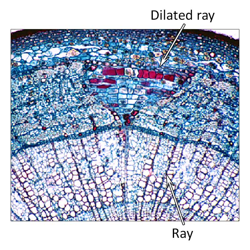 Photo of ray parenchyma cells, pointing out rays and a dilated ray.