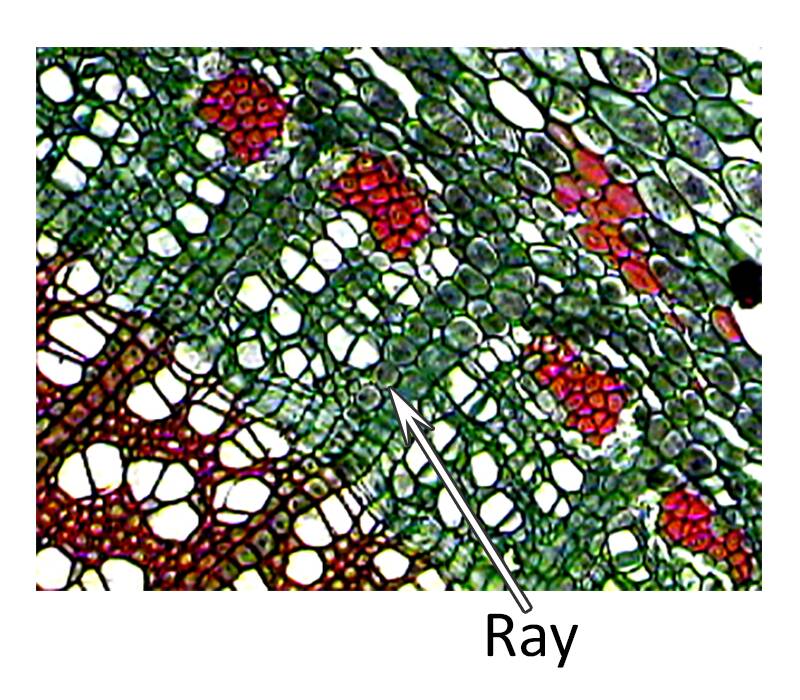 Photo of plant cells pointing out ray cells.