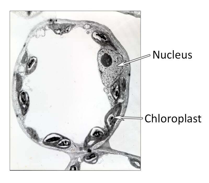 Photo of a mesophyll cell with the nucleus and chloroplast pointed out.