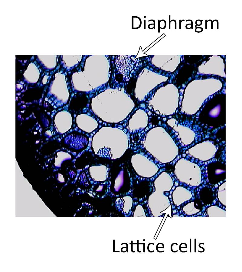Photo of plant cells pointing out lattice cells and diaphragm.