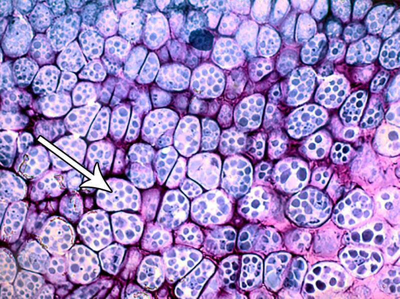 Photo pointing out protein bodies in legume endosperm.