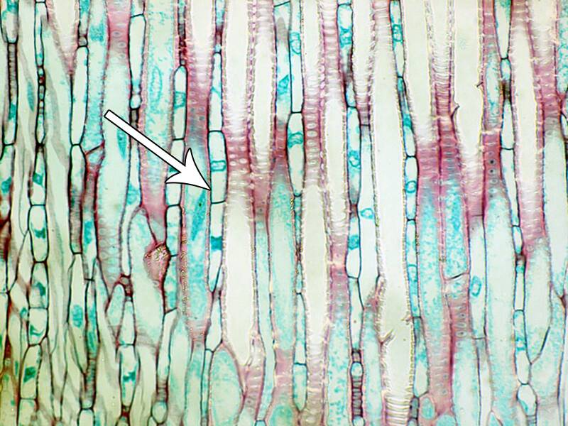 Photo of plant cells pointing out ray parenchyma.