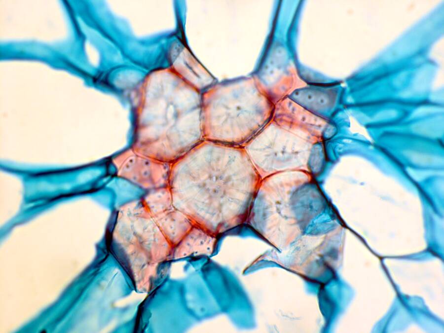 sclerenchyma tissue under microscope