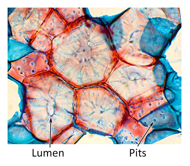 Photo of brachysclereids with lumen and pits pointed out.