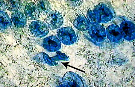 Photo of osterosclereids within a mascerated pea seed coat.