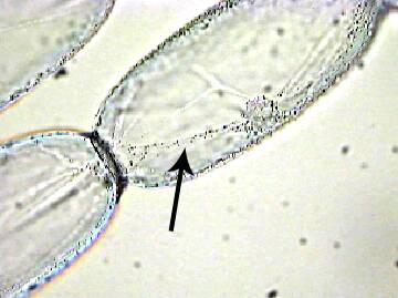 Photo showing trichomes at the cellular level.