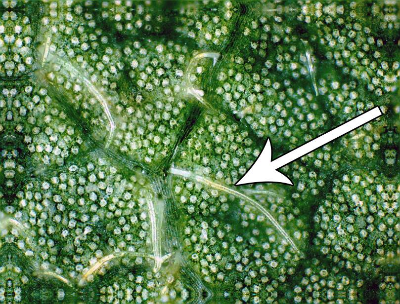 Photo showing examples of single trichomes.
