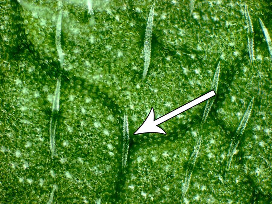 Photomicrograph of the types of trichomes as seen under the microscope