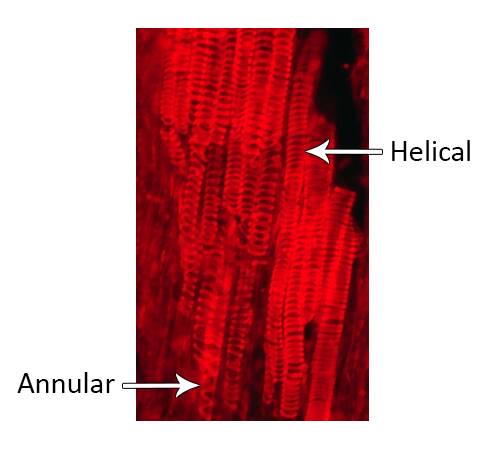 Altered color photo showing actual plant protoxylem with annular and helical secondary wall thickening in comparison to the preceding illustration.