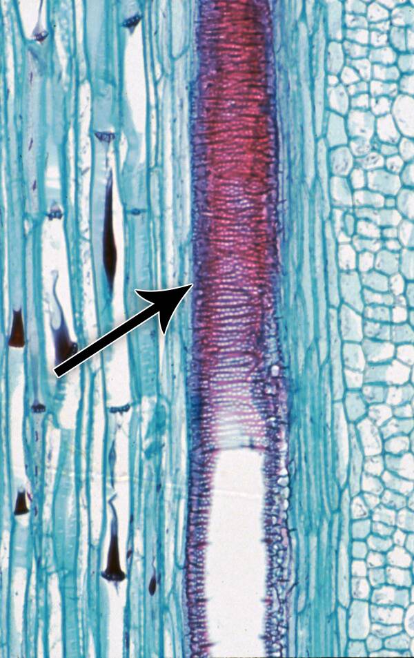 Color altered photo of plant material showing the same scalariform thickening as in the preceding illustration.