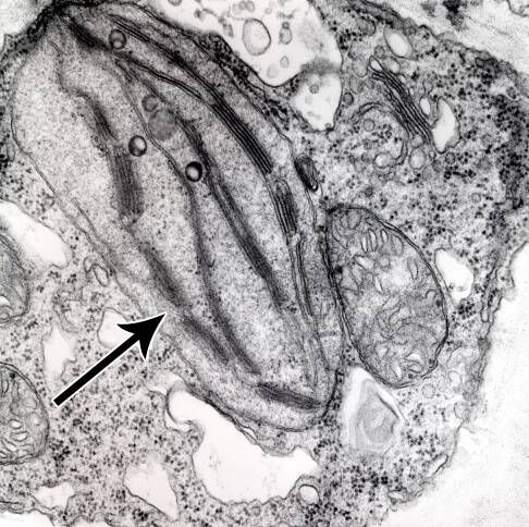 Electorn micrograph of a chloroplast pointing out the inner memberane system.