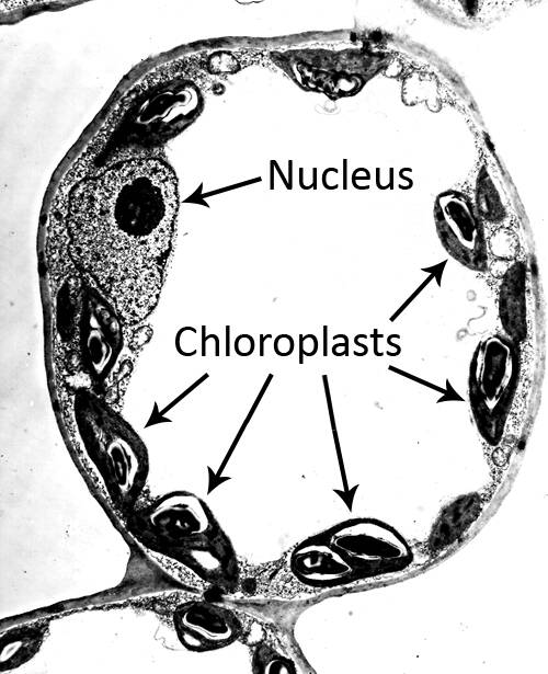 Electron micrograph of a plant cell with the nucleus and multiple chloroplasts pointed out.