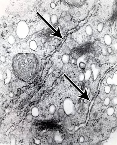 Electron micrograph showing the two parallel memberanes of the ER.