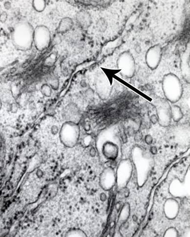 endoplasmic reticulum micrograph