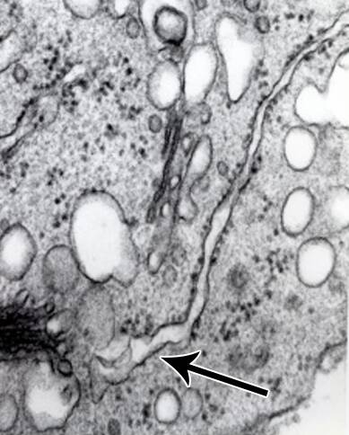 Electron micrograph with smooth ER identified.