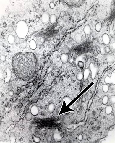 Electron micrograph of a cell identifying the golgi body.
