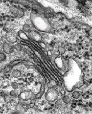 Electron micrograph showing cell components for student to identify.