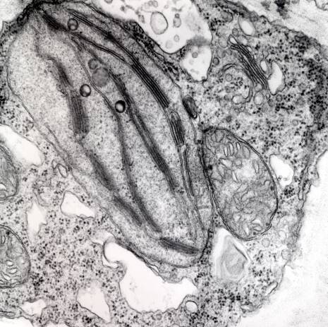 Electron micrograph of plant cells.