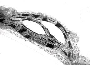 Electron micrograph of a chloroplast.