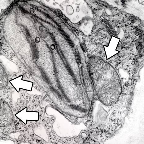 Electron micrograph of a cell with mitochondria identified.