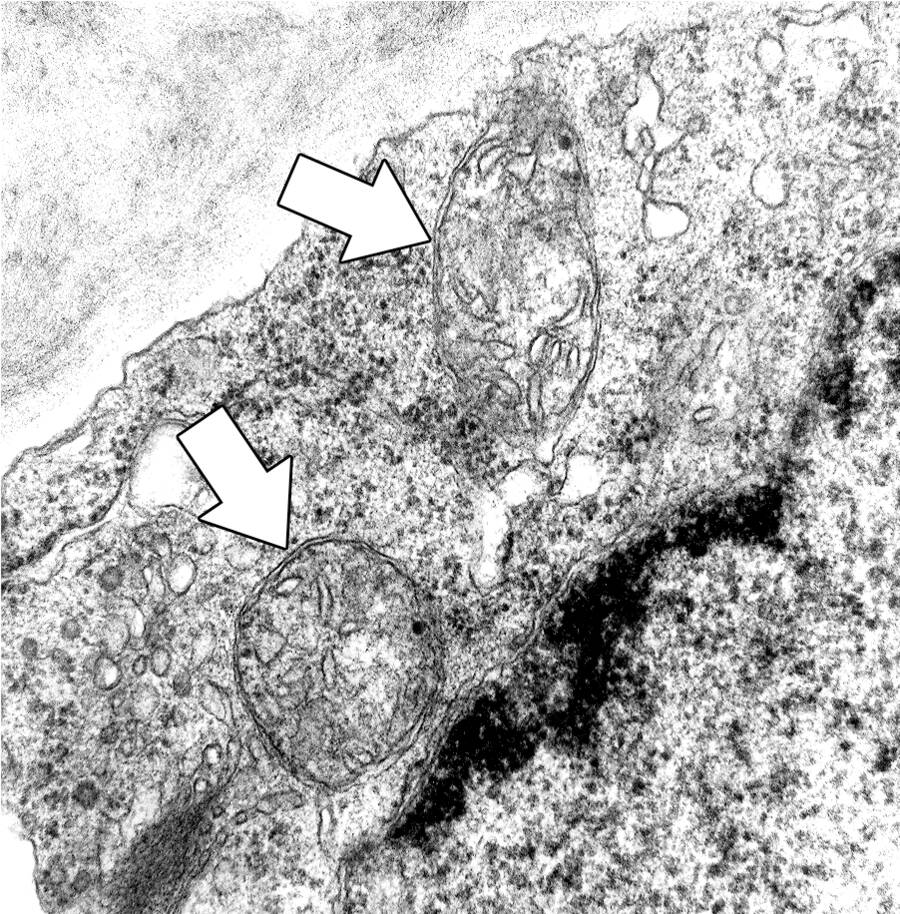 Electron micrograph with a closer view of mitochondria.