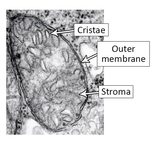Electron micrograph of a mitochondria with the cristae, outer membrane, and stroma identified.