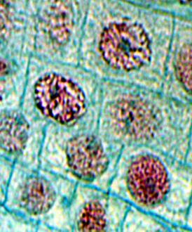 Photo of plant cells with nucleus visible.