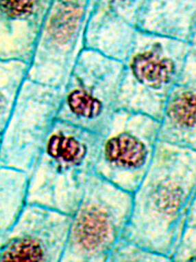 Photo of plant cells with nucleus visible.