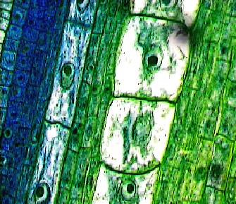 Photo of various cell types from a section of plant stem.