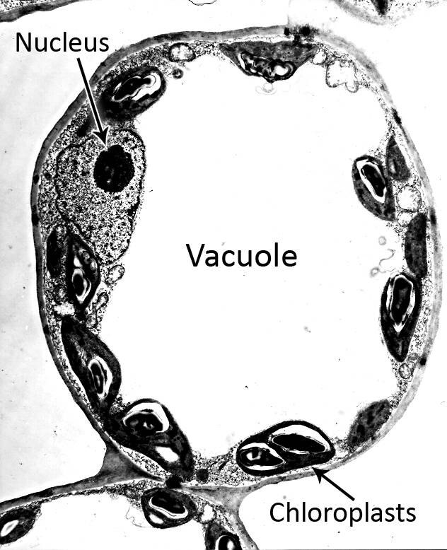Electron micrograph of a plant cell with the nucleus, vacuole, and chloroplasts identified. 