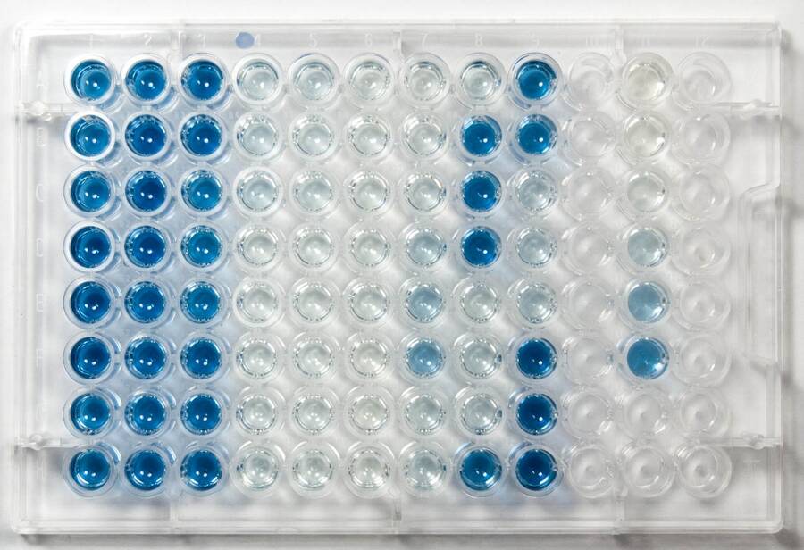 Photo showing an example of an ELISA test.