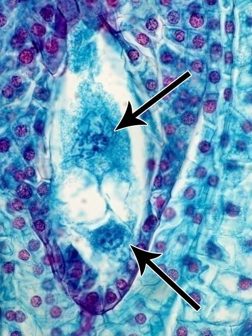 Micrograph with arrows identifying haploid nuclei within ovule (embryo sac) of female ametophytes.