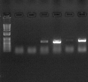 Photo of PCR (polymerase chain reactions)