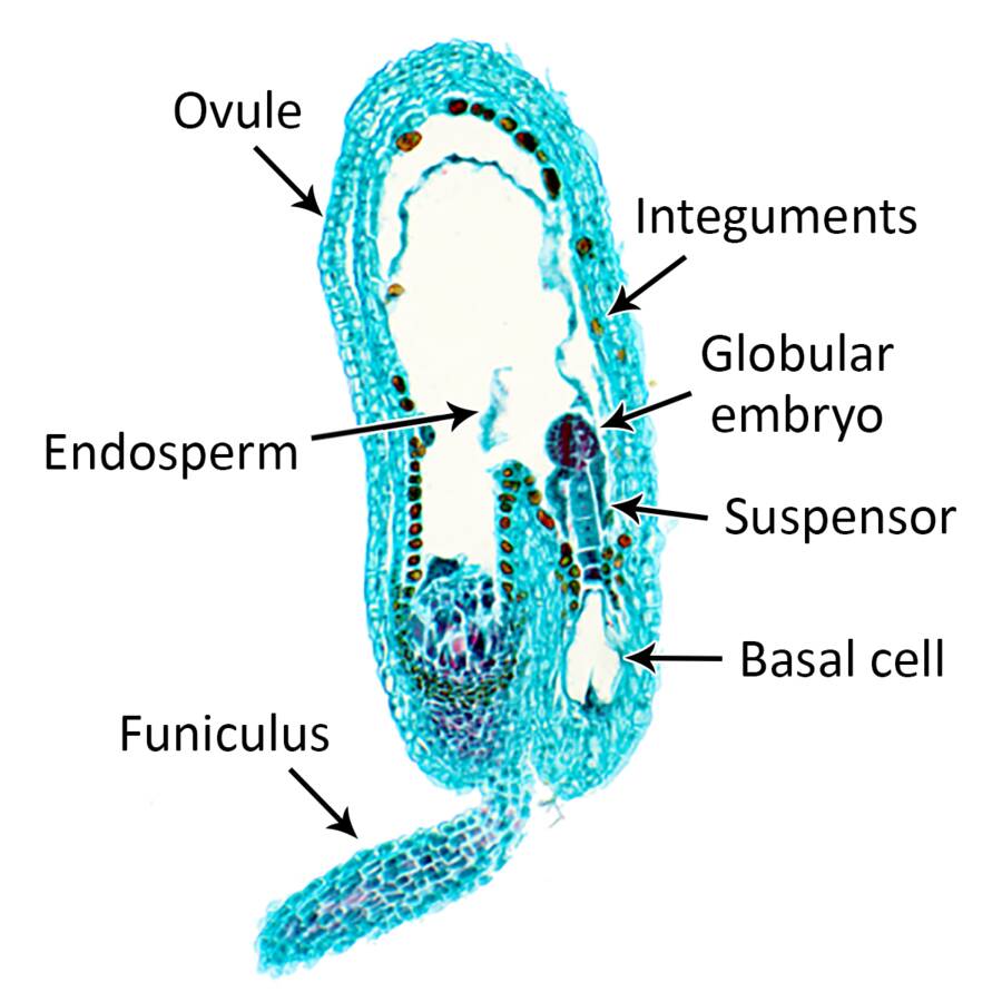 Micrograph cross section of the globular stage of dicot embryogenesis. The ovule, integuments, globular embryo, suspensor, basal cell, funiculus, and endosperm are identified.