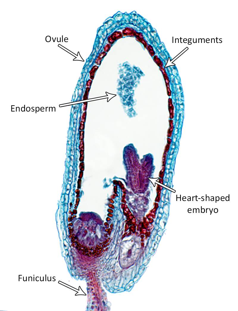 Micrograph cross section of the cotyledon stage of dicot embryogenesis. The funiculus, endosperm, ovule, integuments, and a heart-shaped embryo are identified.