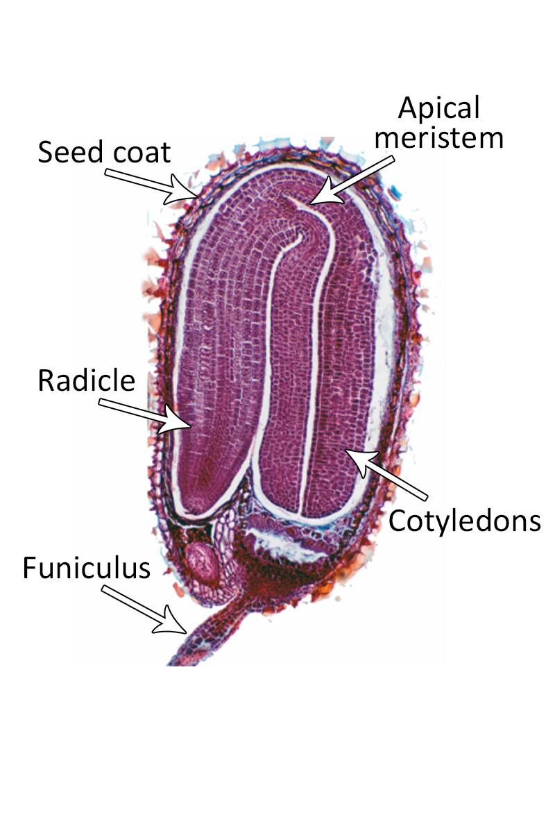 Micrograph of the mature stage of dicot embryogenesis. The funiculus, radicle, seed coat, apical meristem, and cotyledones are identified.