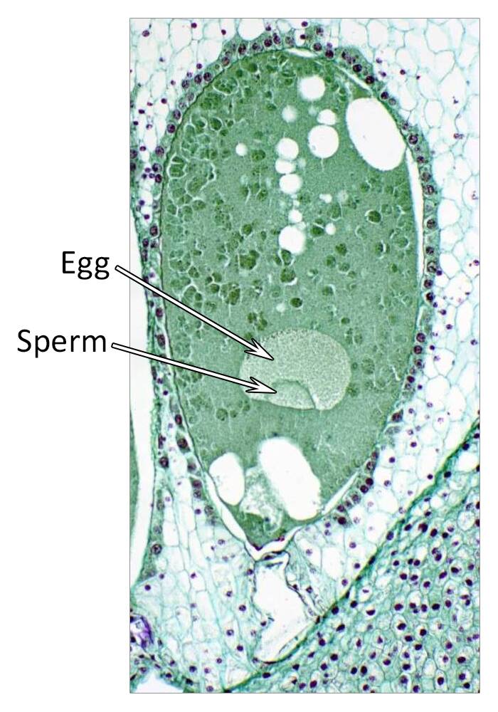Micrograph of a pine gymnosperm embryogenesis. The egg and sperm are identified.
