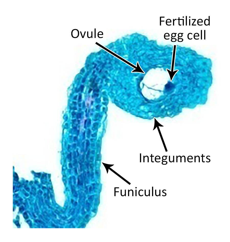 Micrograph showing dicot embryogenesis with ovule, fertilized egg cell, integuments, and funiculus identified.