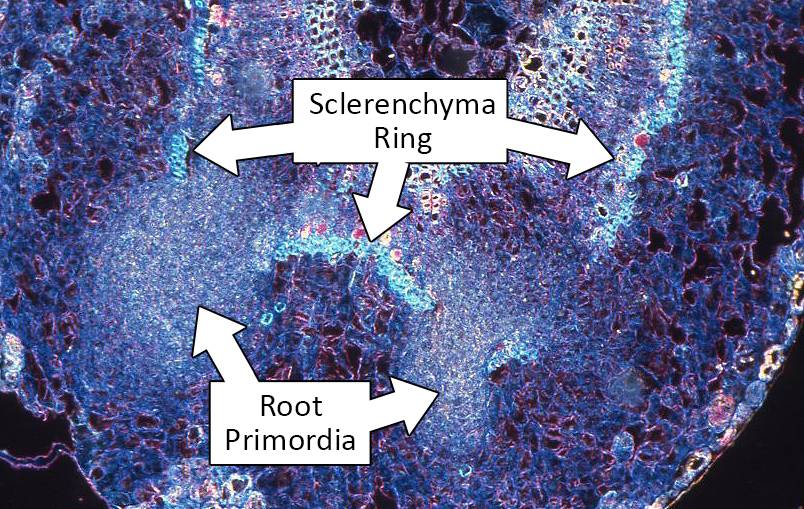 sclerenchyma in stems