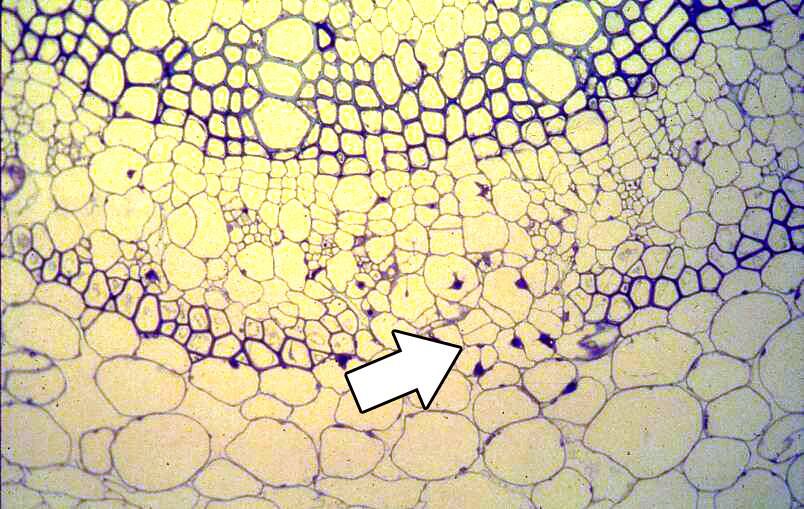 Micrograph with phloem parenchyma cells identifed.