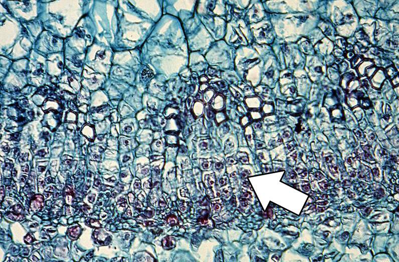 Micrograph with dividing cells identified.