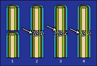 Illustration shwoing four stages of graft union formation.