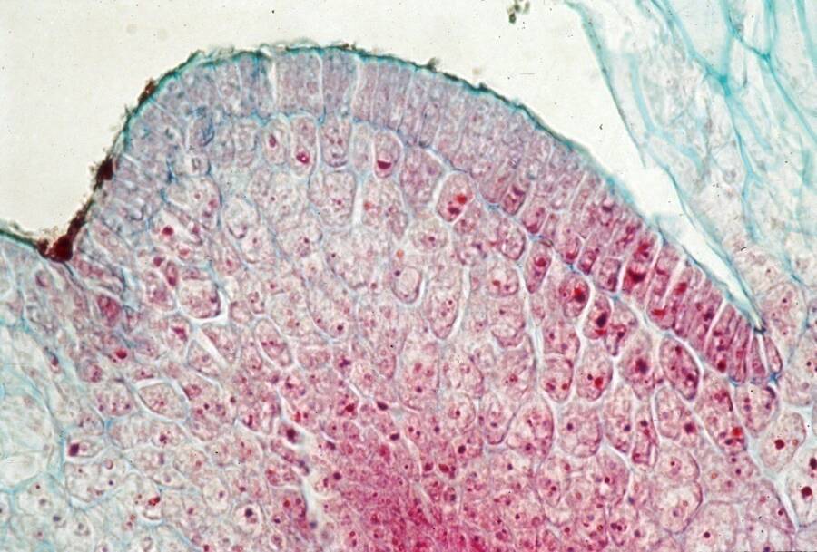 Micrograph of somatic ebryo cells in the induction stage.